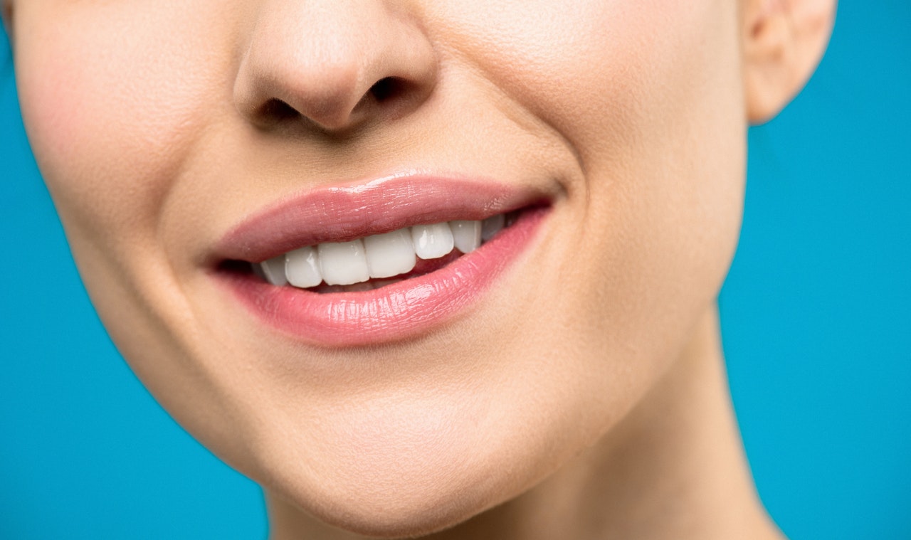 Відбілювання зубів вдома: чи можна змінити колір посмішки в домашніх умовах?